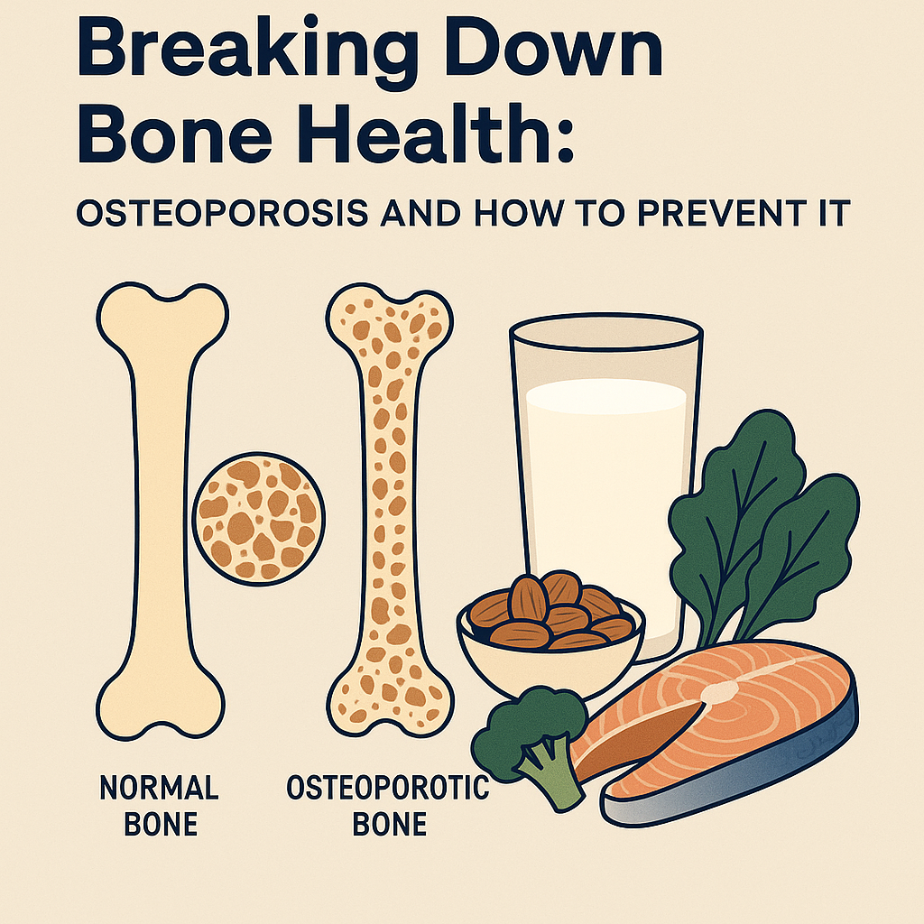 Breaking Down Bone Health: Osteoporosis and How to Prevent It